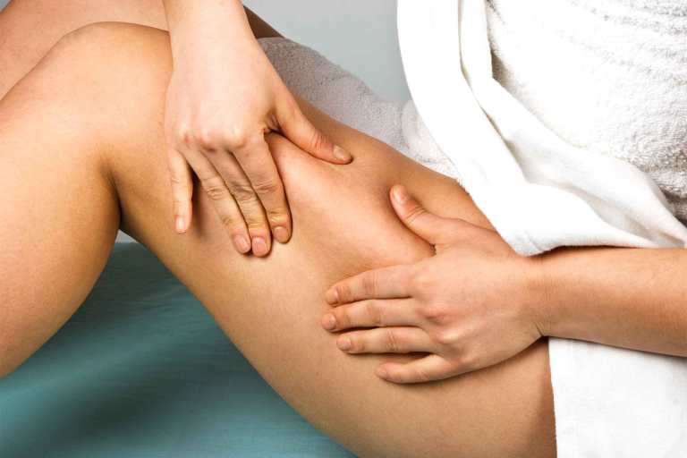 Selülit Neden Oluşur? Ne İyi Gelir? Doğal Tedavisi ve Egzersizler