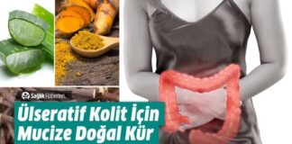 Ülseratif Kolit Nedir Nedenleri Belirtileri Nelerdir Doğal Yollarla Tedavisi