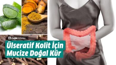 Ülseratif Kolit Nedir Nedenleri Belirtileri Nelerdir Doğal Yollarla Tedavisi