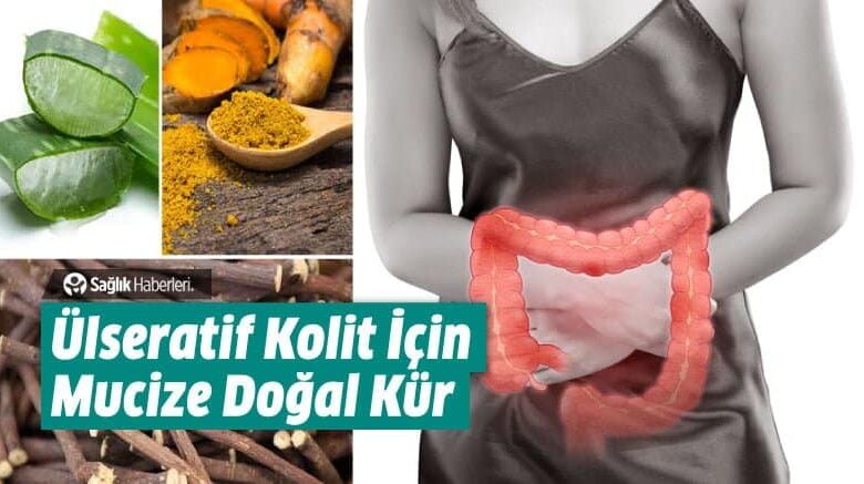 Ülseratif Kolit Nedir Nedenleri Belirtileri Nelerdir Doğal Yollarla Tedavisi