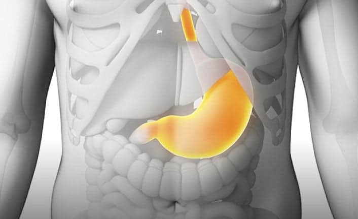 Akalazya Nedir Belirtileri ve Tedavi Yöntemleri Nelerdir