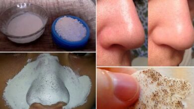 Yüzdeki Siyah Noktalar Nasıl Temizlenir En Etkili Siyah Nokta Maskeleri