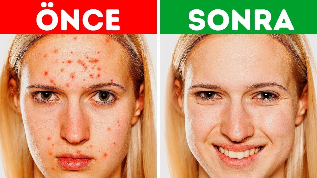 maxresdefault 2 Parlak ve Pürüzsüz Bir Cilt İçin Ev Yapımı 10 Kolay Maske