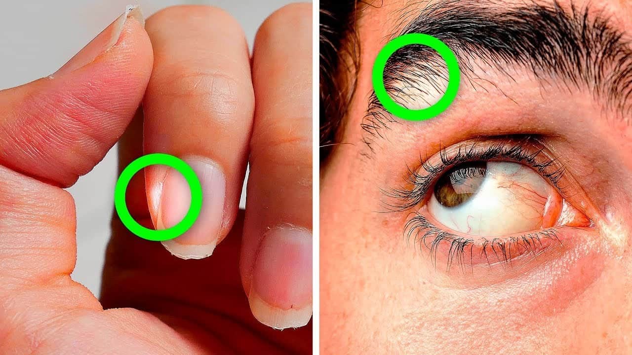 maxresdefault 25 Bu erken uyarı işaretleri tanıdık geliyorsa, sizde beslenme zafiyeti var