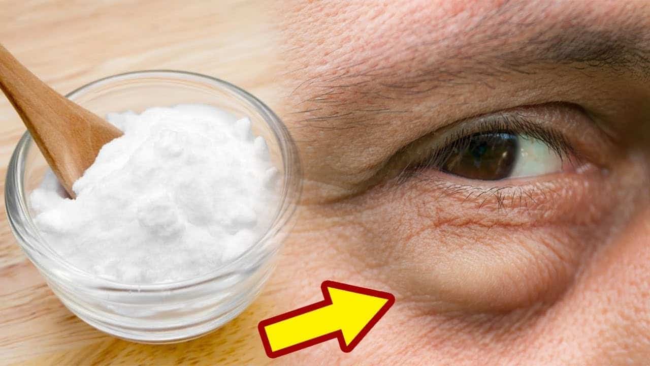 q5CkLm1yoGY Göz altı torbaları ve morluklardan bir günde kurtulmak ister misiniz?