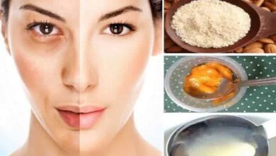saglikhaberleri 2018 15 Muz, Limon ve Yoğurt İle Melasma Tedavisi Nasıl Yapılır?
