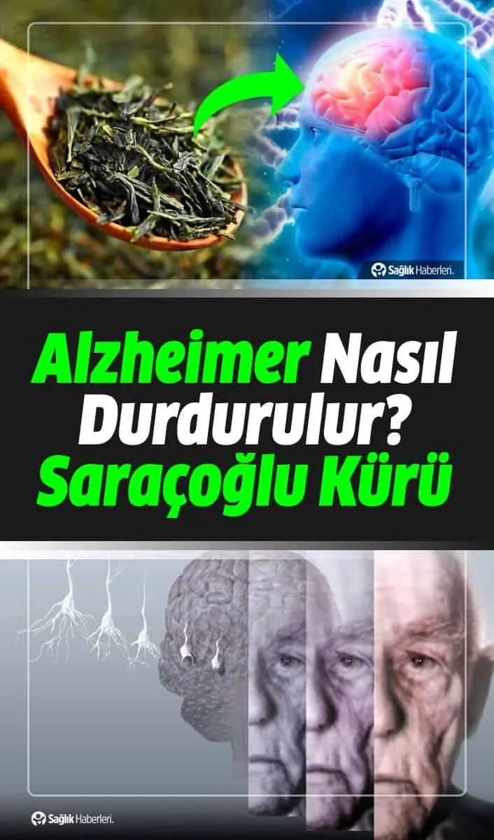 Alzheimer Neden Olur, Belirtileri Neler? Saraçoğlu Alzheimer Kürü