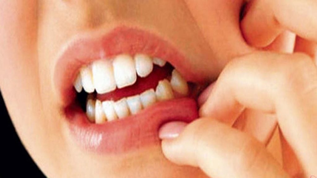 Diş Eti Kanaması Neden Önemlidir? Tedavisi Sağlık Haberleri