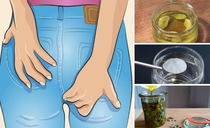 Hemoroid Belirtileri Neler, Evde Nasıl Geçer Saraçoğlu Kürü Sağlık
