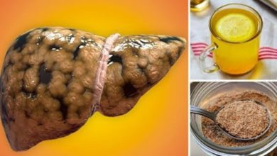 Karaciğer Yağlanması Neden Olur, Nasıl Temizlenir? Bitkisel Tedavisi