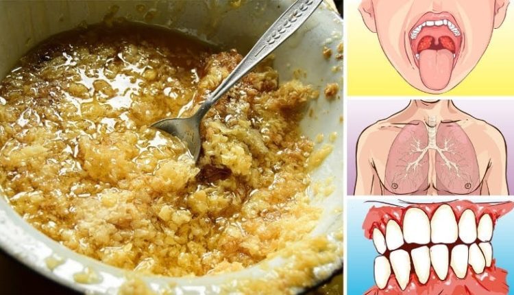 Propolis Nedir? Propolisin Faydaları Nelerdir? Nasıl Kullanılır?
