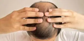 Saçlar neden dökülür, Ne iyi gelir? Saç dökülmesini önleyen bitkisel kürler