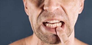 Diş eti ağrısına neler sebep olabilir? Diş eti ağrısı nasıl geçer? Tedavisi