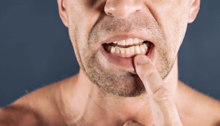 Diş eti ağrısına neler sebep olabilir? Diş eti ağrısı nasıl geçer? Tedavisi
