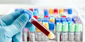 Gebelik ve doğum öncesi mutlaka yapılması gereken testler!
