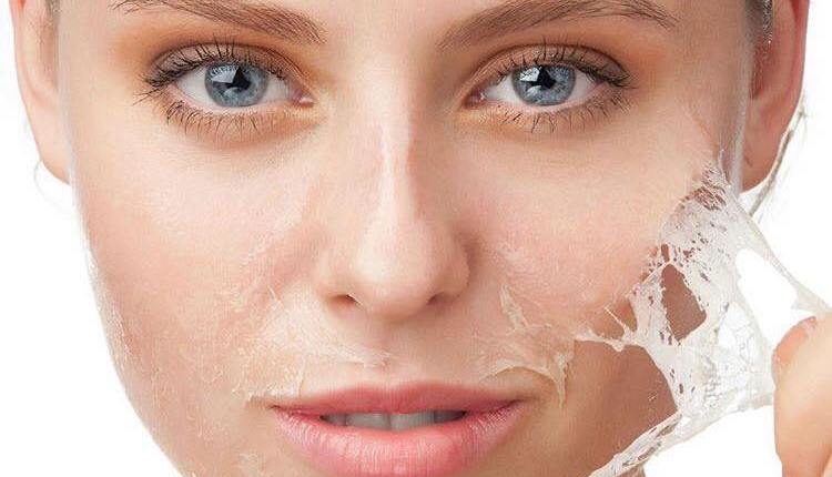 Peeling nedir? Peeling niçin, nasıl yapılır? Faydaları neler?