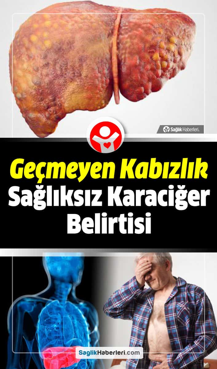 Sağlıksız karaciğerin belirtileri nelerdir?
