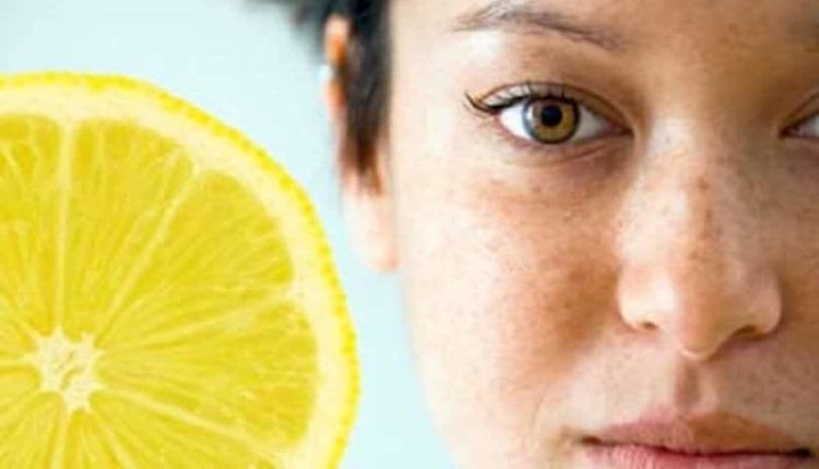 Yüzdeki güneş lekeleri nasıl geçer? Yüzdeki güneş lekelerine bitkisel çözüm