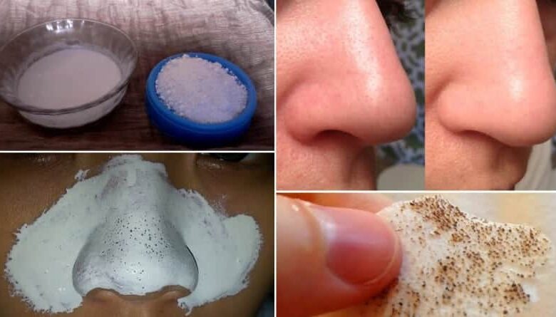 Doğal olarak siyah noktalar evde nasıl yok edilir?