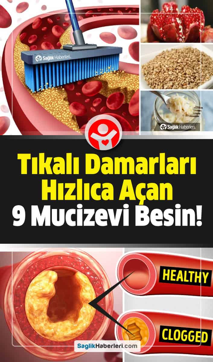 Tıkalı damarları hızlıca açan en iyi 9 besin!