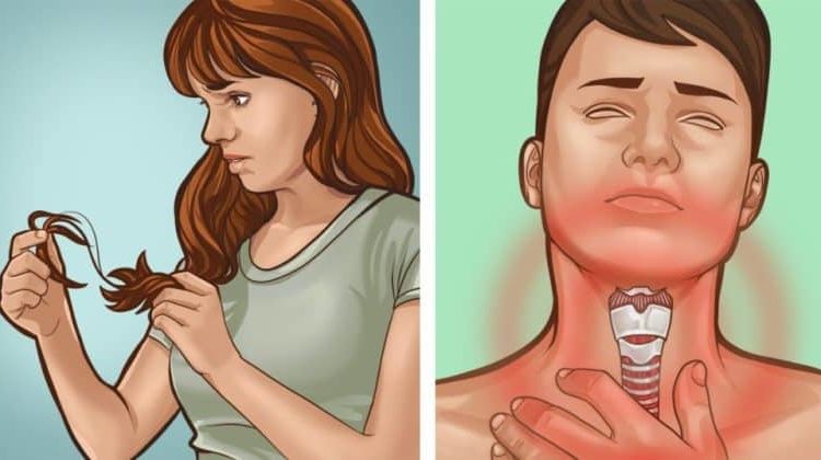 İyot eksikliğinin bu 10 belirtisini göz ardı etmeyin!