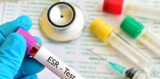 Sedimantasyon nedir, ne işe yarar? Testi nasıl yapılır?