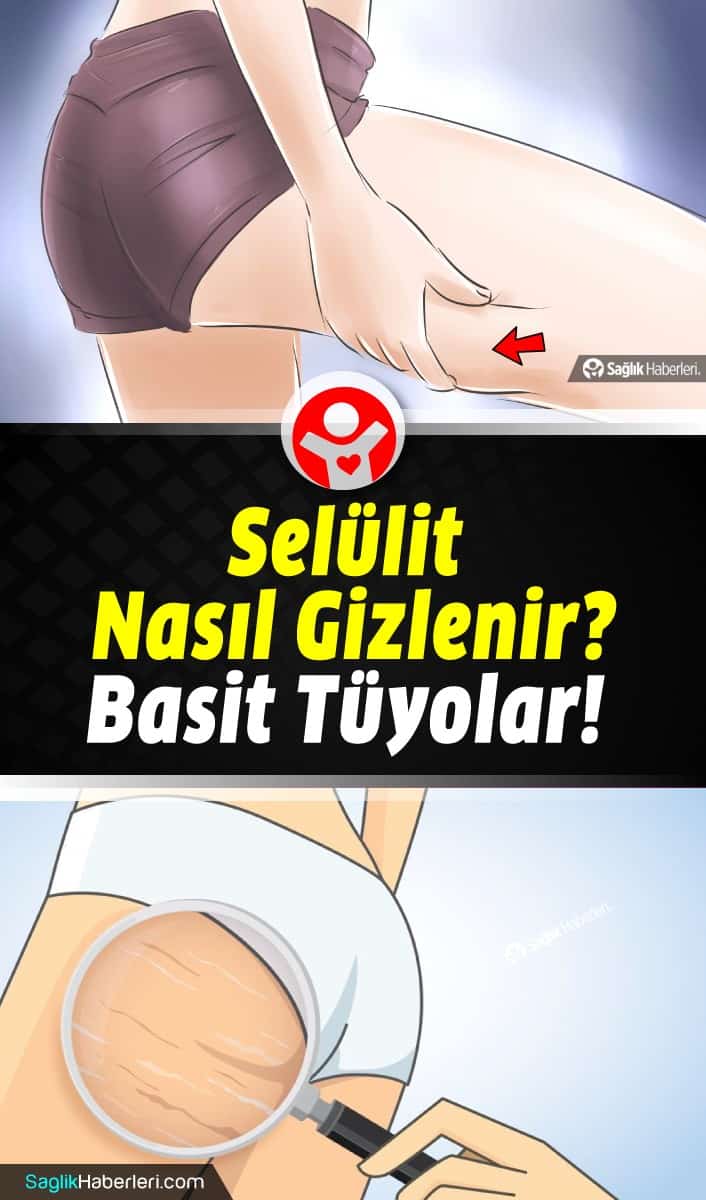 Selülit nasıl gizlenir? Selüliti gizleme yolları neler?