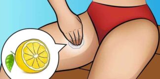 Genital bölgede kahverengi lekeler neden olur, nasıl giderilir?