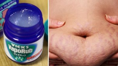 Vicks VapoRub göbek yağlarını ve selüliti yok etmek için nasıl kullanılır?