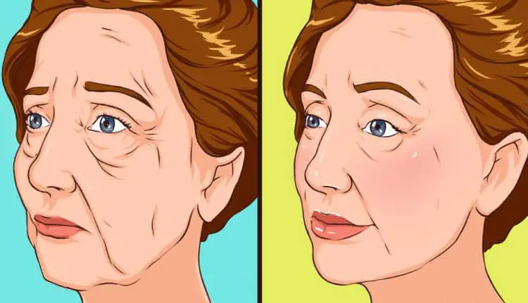 Yanak sarkması nedir, neden olur? Doğal çözümler neler?
