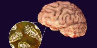 ABD'de musluk suyunda beyin yiyen mikrop tespit edildi