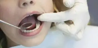 Bir diş doktorunun ağzınızın içine bakarak söyleyebileceği 5 şey!