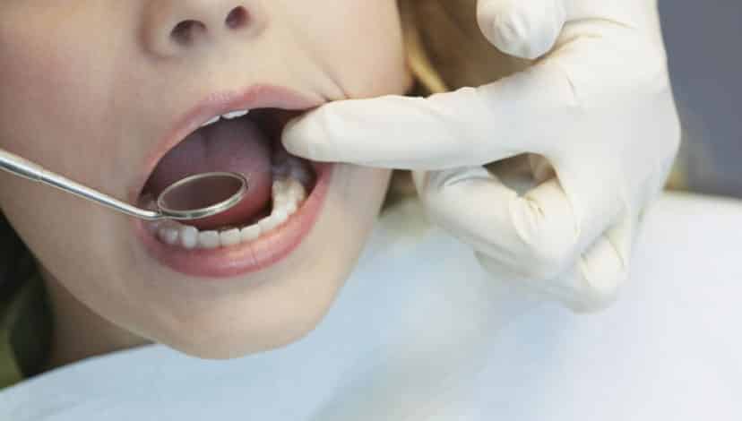 Bir diş doktorunun ağzınızın içine bakarak söyleyebileceği 5 şey!