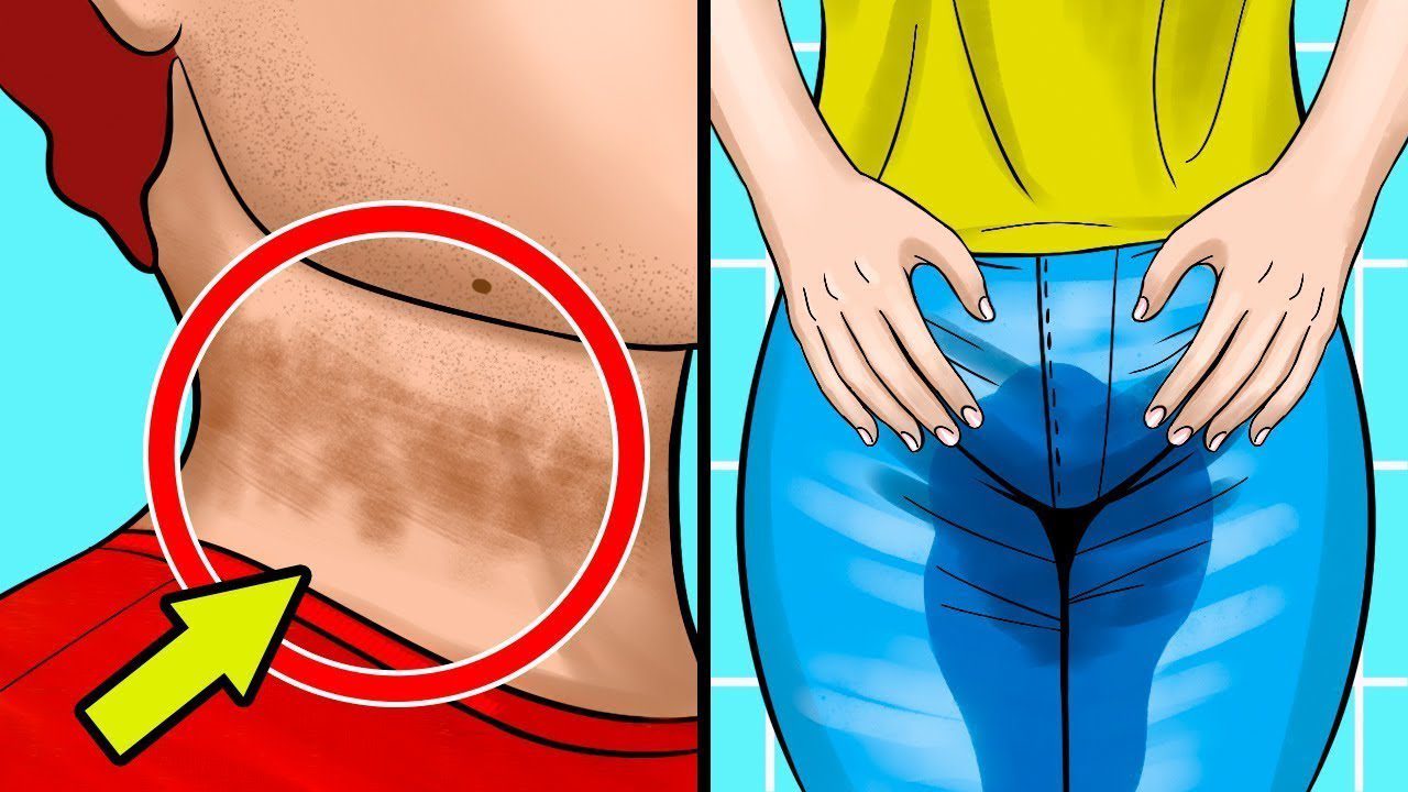 bu 10 belirti gizli seker hastaligina isaret ediyor onlem alin 1 Bu 10 belirti gizli şeker hastalığına işaret ediyor. Önlem alın!