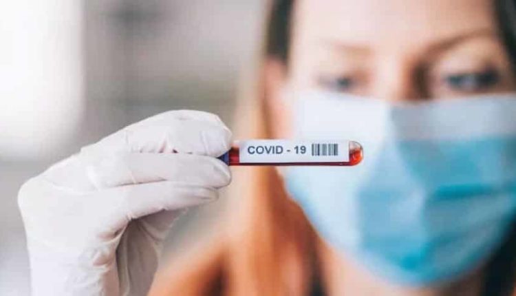 Yeni tip koronavirüs döneminde yapılan antikor testi nedir?