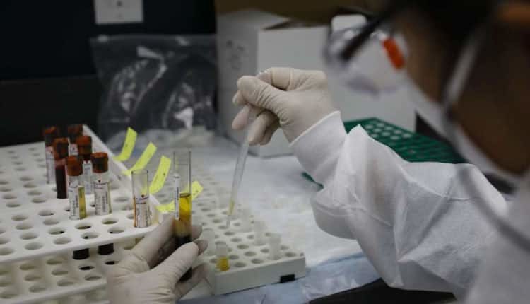 Covid-19 sürecinin ne kadar şiddetli geçirileceğini belirleyen test geliştirildi