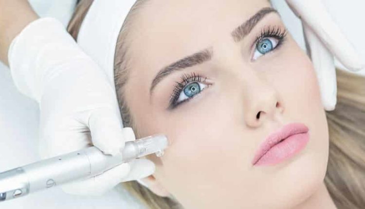 Dermapen nedir? Dermapen hangi mevsimde, nasıl yapılır?
