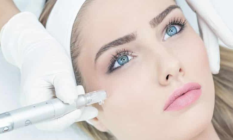 Dermapen nedir? Dermapen hangi mevsimde, nasıl yapılır?