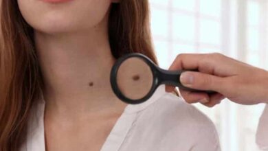 Görmezden gelmemeniz gereken 7 cilt kanseri uyarı işareti