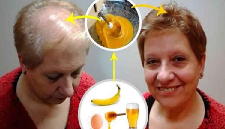 Saçlarınızı deli gibi uzatacak doğal karışım!