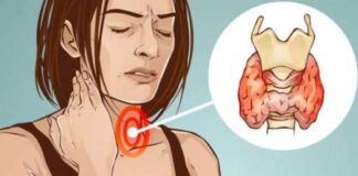 Tiroid sorununuz olduğunu gösteren 10 işaret ve ondan kurtulma yolları