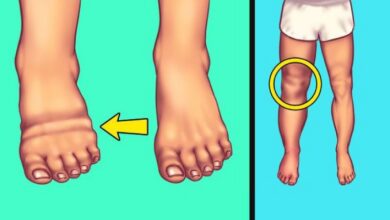 Ödem nedir, neden olur? Ödem atma yolları ve Saraçoğlu kür tarifleri