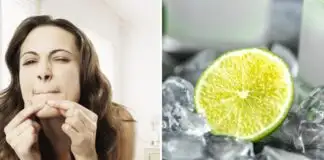 Limon ve buz ile sivilce maskesi nasıl yapılır?