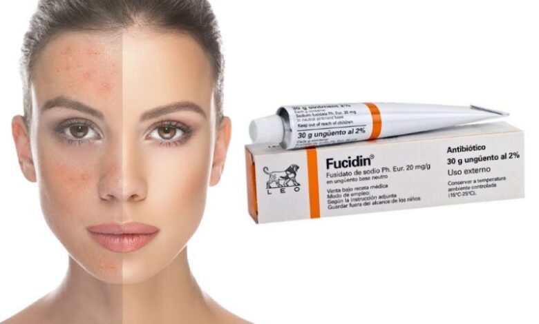 Fucidin Krem Nedir, Ne İçin Kullanılır?