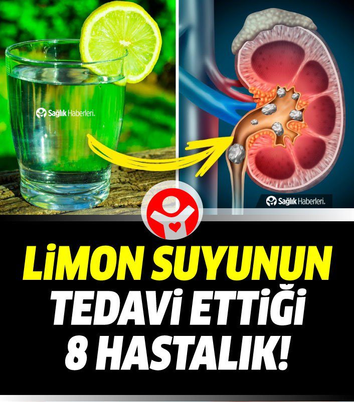 Limon suyu neye iyi gelir? Limon suyu ile tedavi edebileceğiniz 8 sağlık problemi