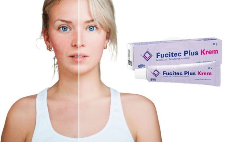 Fucitec krem yüze sürülür mü, yanık için kullanılır mı? 1 Fucitec krem yüze sürülür mü, yanık için kullanılır mı?