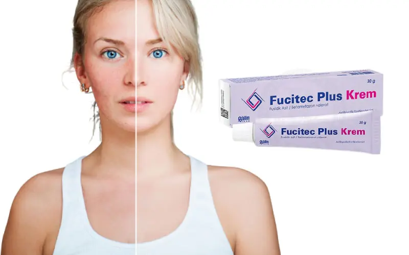 Fucitec krem yüze sürülür mü, yanık için kullanılır mı? 60 Fucitec krem yüze sürülür mü, yanık için kullanılır mı?