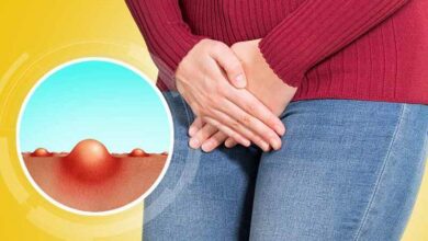 Genital bölgede sivilce doğal çözüm, bitkisel tedavi