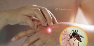İstanbul'da sivrisinekler hayatı kabusa çevirdi