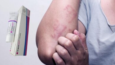 Travocort krem vajinal mantara, egzamaya iyi gelir mi?